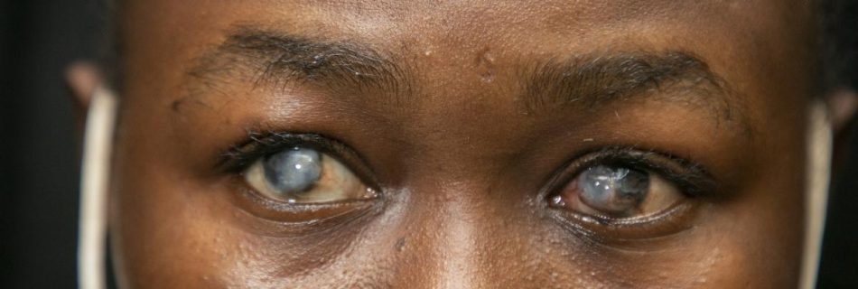 Blindness Prevention Programme Article on Major Causes of Blindness
